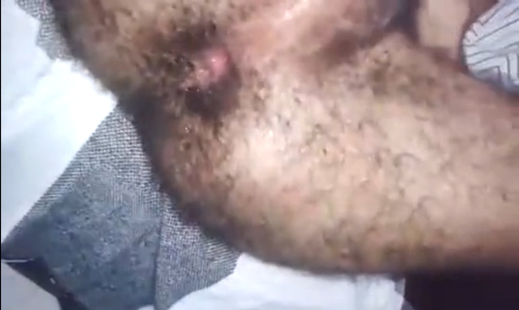 Cuzinho Delícia Peludo